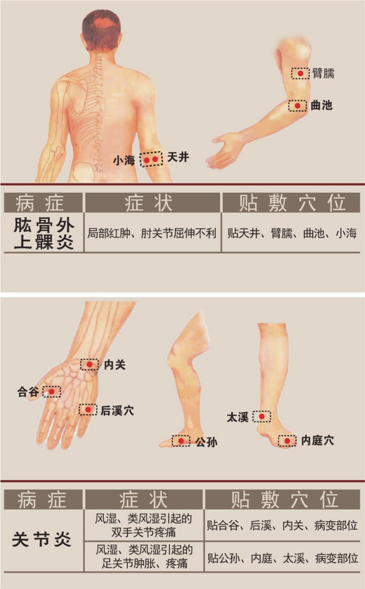 關(guān)節(jié)炎病癥貼敷穴位圖詳解-佰世修康