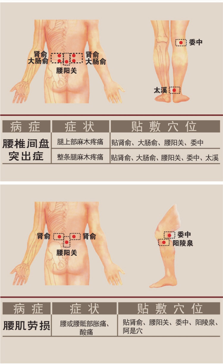 腰間盤(pán)突出癥狀貼敷穴位圖詳解-佰世修康