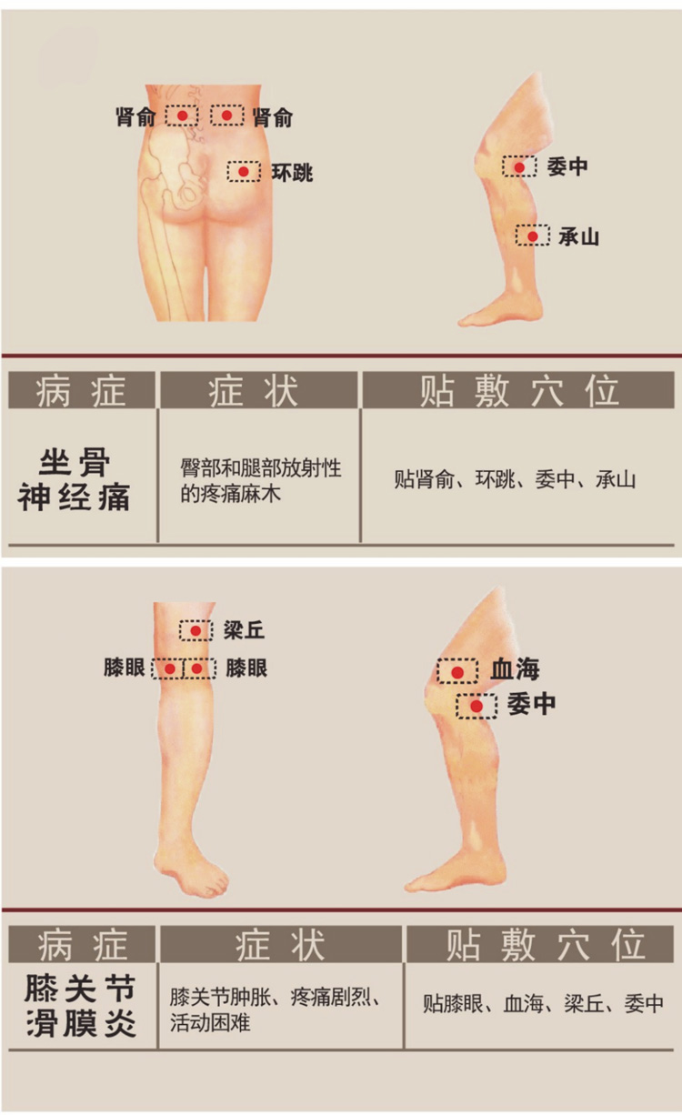 坐骨神經(jīng)痛癥狀膏藥貼敷穴位圖詳解