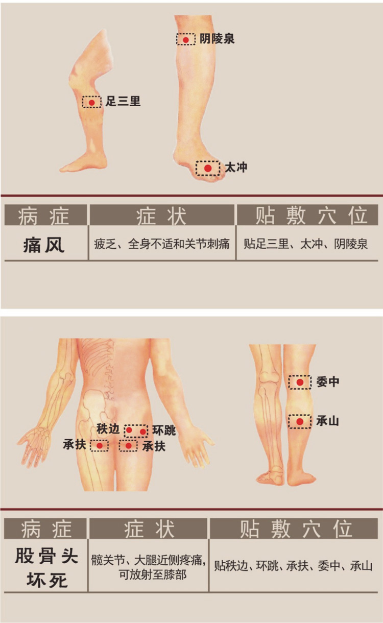 痛風(fēng)癥狀膏藥貼敷穴位圖詳解